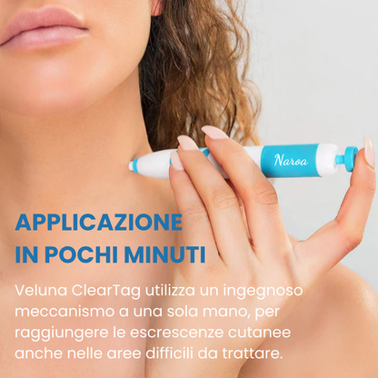 ClearTag™ - Kit per la rimozione delle escrescenze cutanee