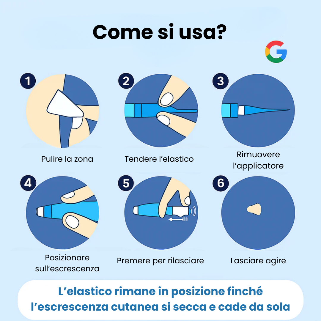 ClearTag™ - Kit per la rimozione delle escrescenze cutanee