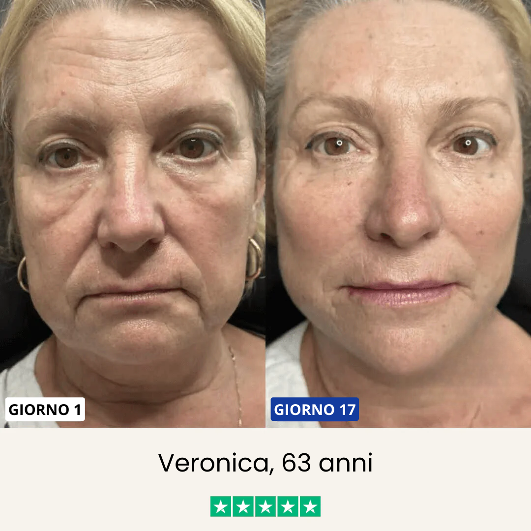 Chinology - Maschera Lifting per doppio mento