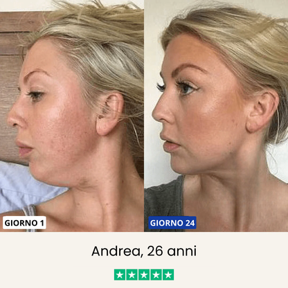 Chinology - Maschera Lifting per doppio mento