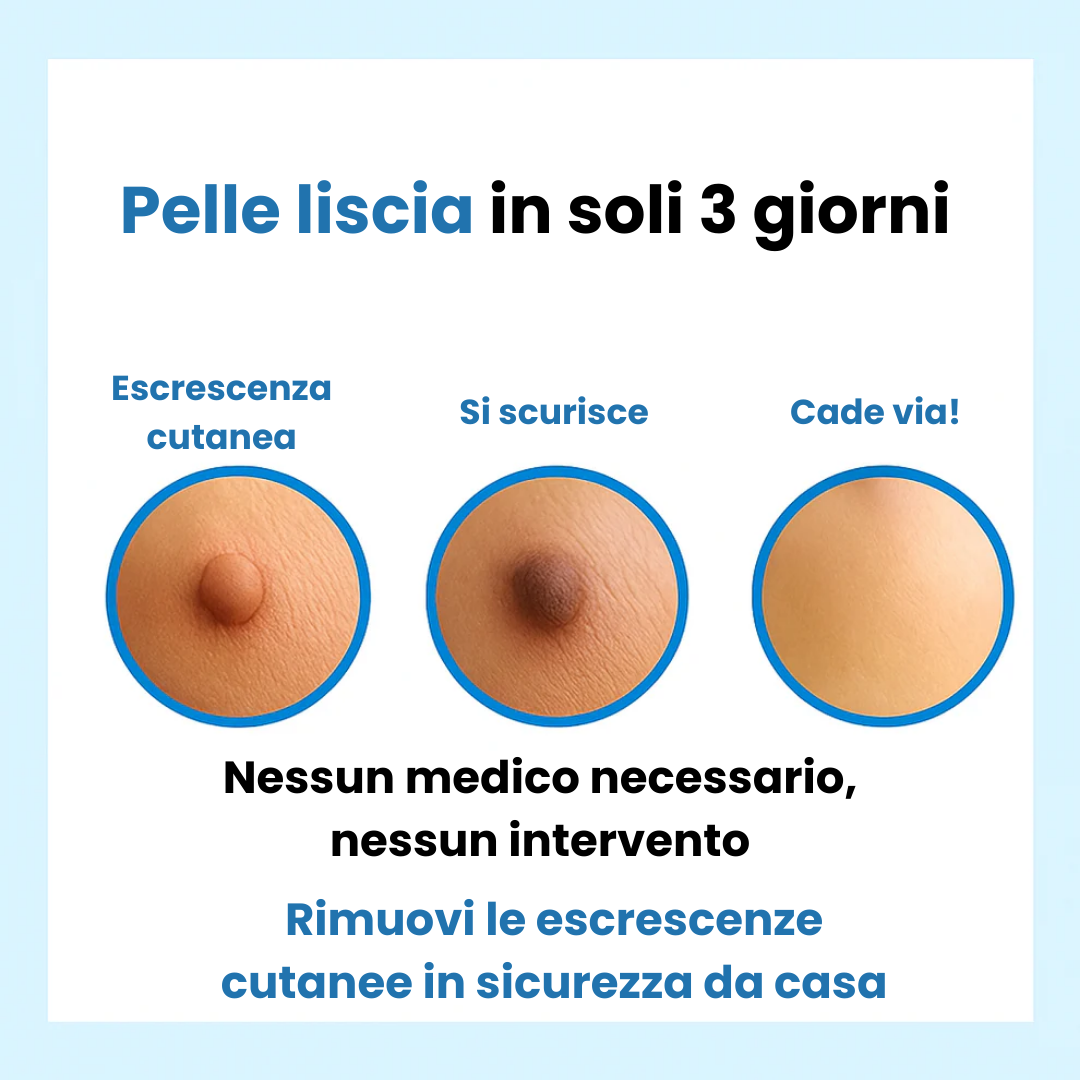 ClearTag™ - Kit per la rimozione delle escrescenze cutanee