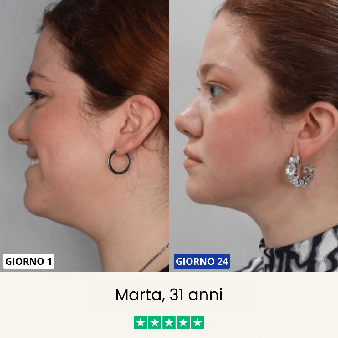 Chinology - Maschera Lifting per doppio mento