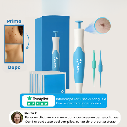 ClearTag™ - Kit per la rimozione delle escrescenze cutanee